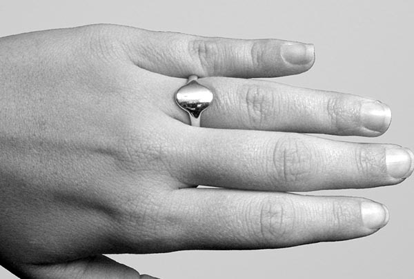 silverring_0001_trigger SilverRing™ Trigger Splint